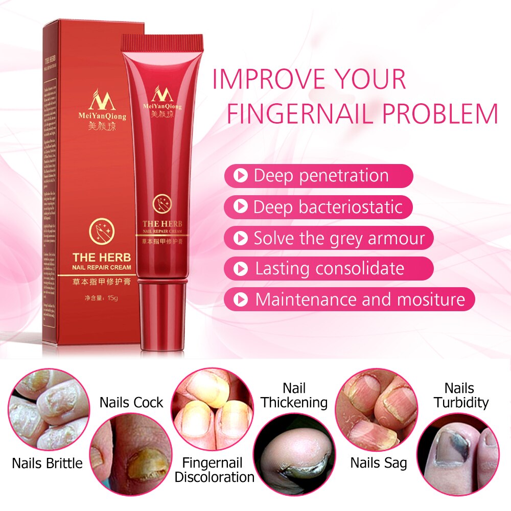 Nail Cream Protector for Repair Fungus Treatment